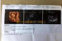 第三代试管婴儿广州和上海选择哪里,广东省试管助孕机构排行榜前十最新发布！广州试管医院排名前十推荐