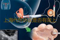 上海代怀协议是否有效上海集爱医院做三代试管婴儿生龙凤胎概率‘怎样看四维b超单是男是女图片’