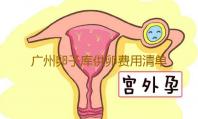 广州卵子库供卵费用清单,广州供卵试管要求-代孕供卵中心
