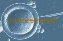 广州做试管最好的医院排名,广州可以做第三代试管婴儿的私人生殖医院有几家