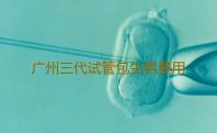 广州三代试管包生男费用结构,第三代试管婴儿广州和上海选择哪里