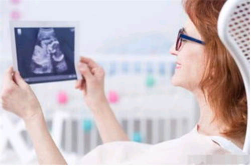 维彩超孕有哪几种四沈阳代是检查什么